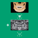Système d’imagerie panoramique 3D / 2D - Smart 2 - Vatech - Safe Implant