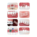 Pansement intra-oral absorbable Bona-aid - Boîte de 20 (15 x 30 mm) - Waldent